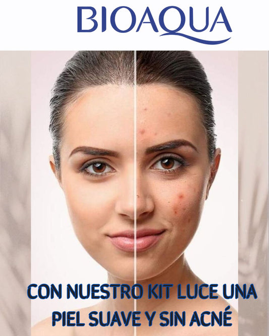 KIT ANTIACNE BIOAQUA